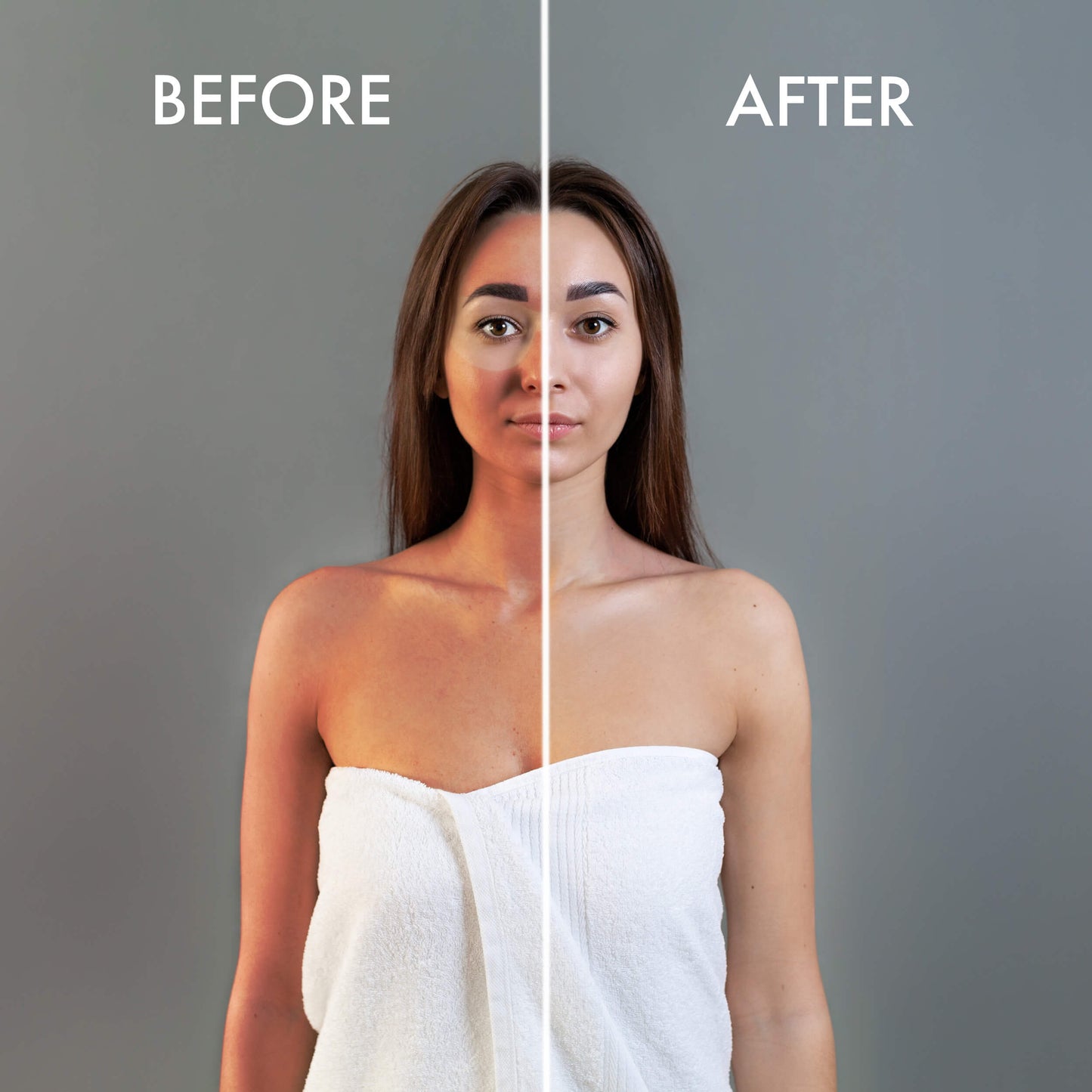 Image Taken Using LUMI400II Medical Clinical Wall Mounted Photography Studio Flash Kit (Before and After)