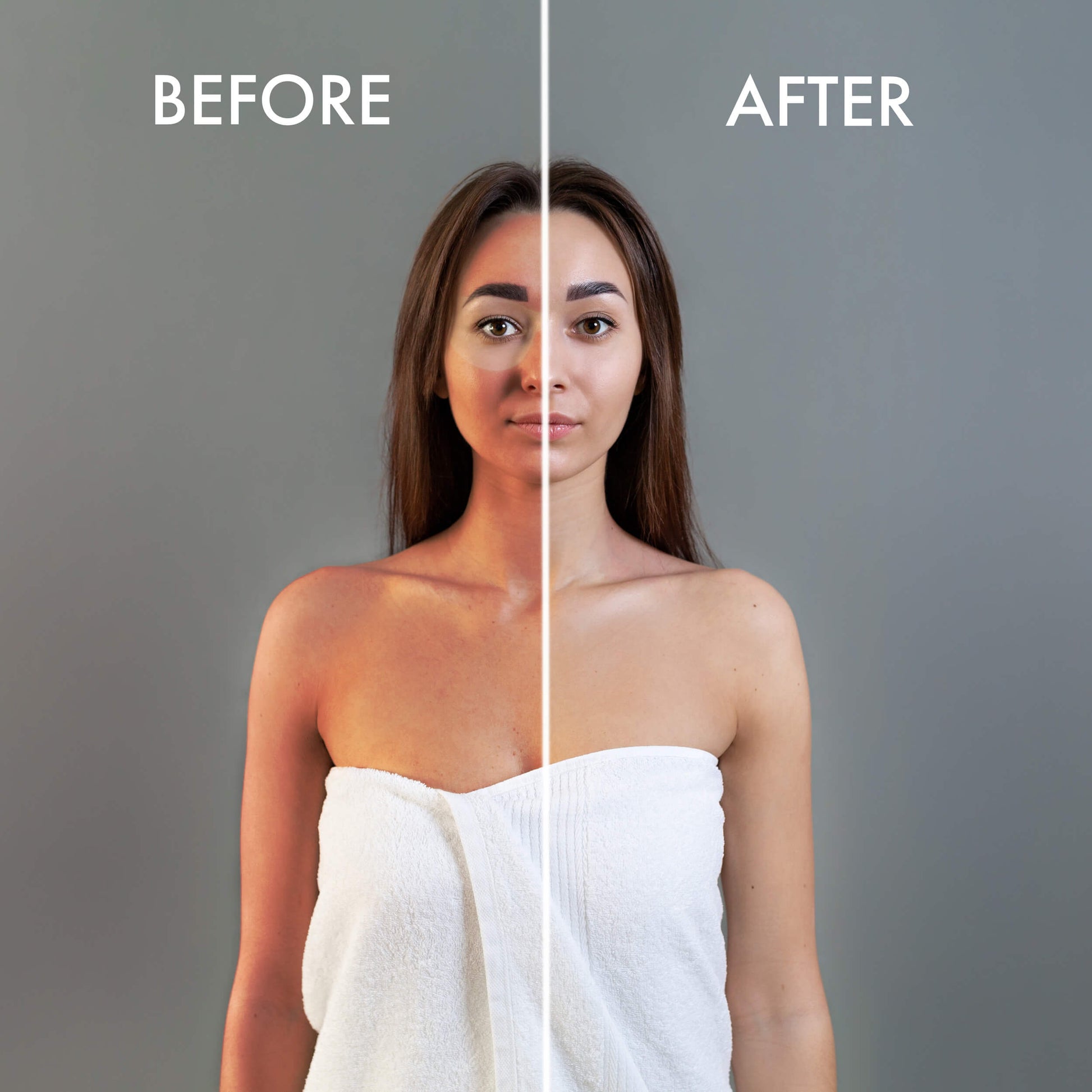 Image Taken Using LUMI400II Medical Clinical Wall Mounted Photography Studio Flash Kit (Before and After)