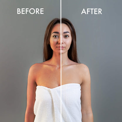Image Taken Using LUMI400II Medical Clinical Wall Mounted Photography Studio Flash Kit (Before and After)
